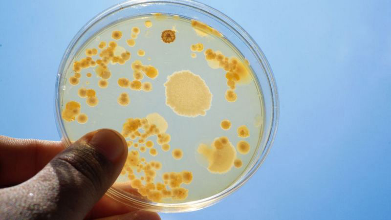 北京消泡劑-北京鄭小姐細(xì)菌發(fā)酵消泡劑使用和應(yīng)用案例